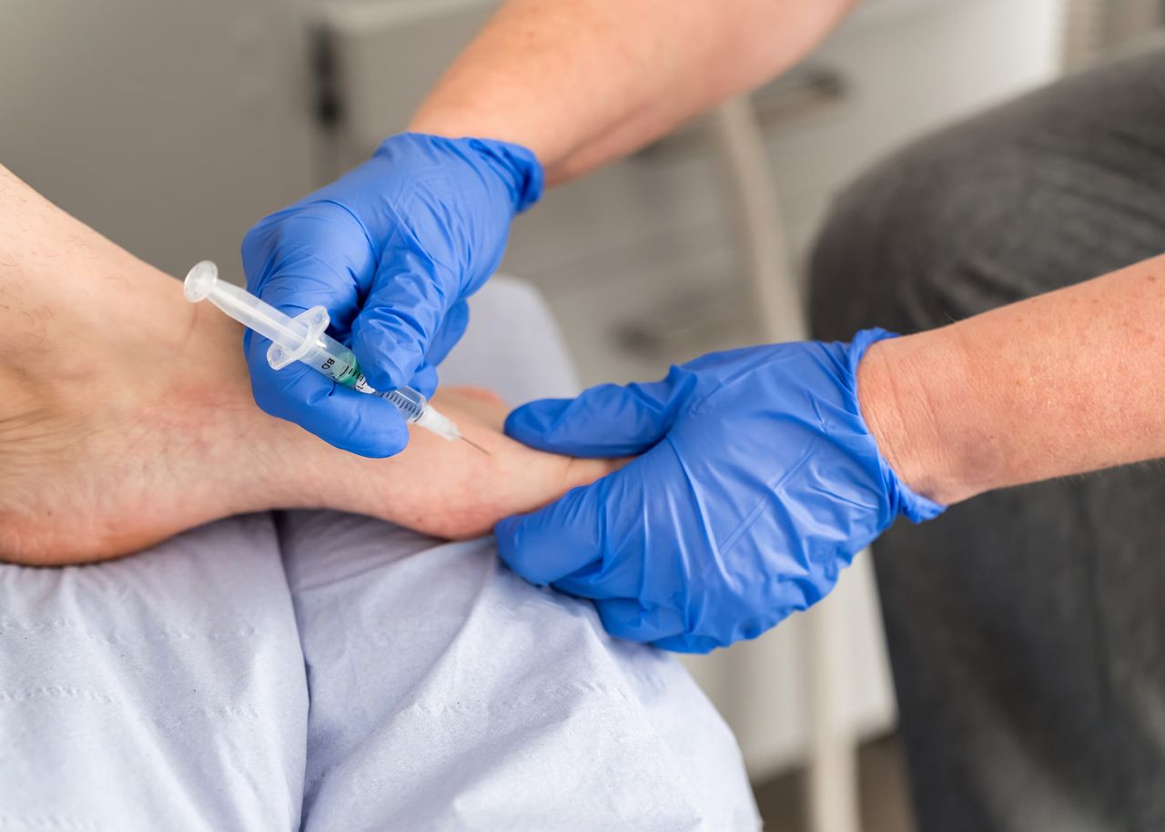 A Chase Podiatry podiatist injecting the side of a patients foot